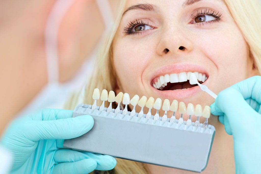 porcelain veneers aftercare in Cary North Carolina