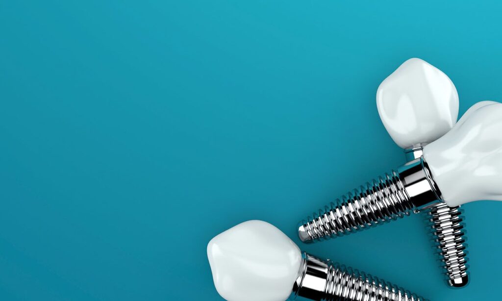 types of dental implants Cary North Carolina