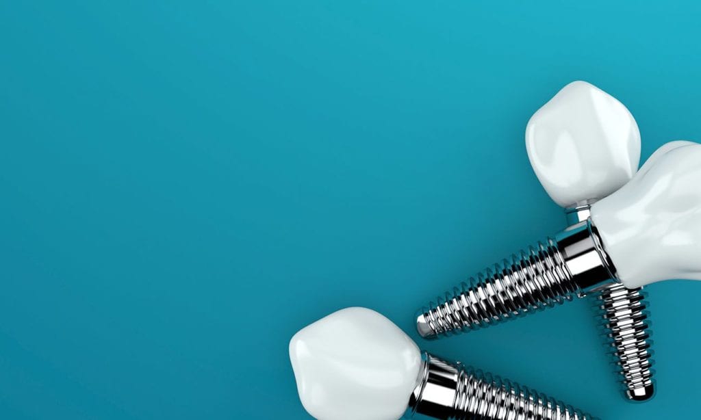 Benefits of Dental Implants Cary NC