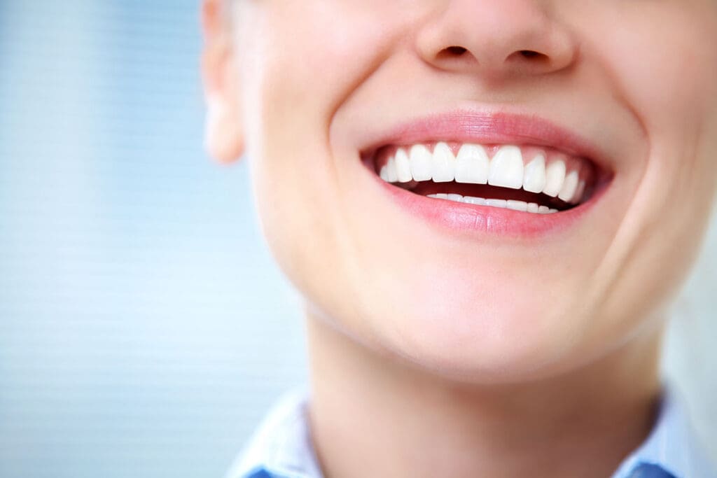 Brighten Yellow Teeth in Cary NC
